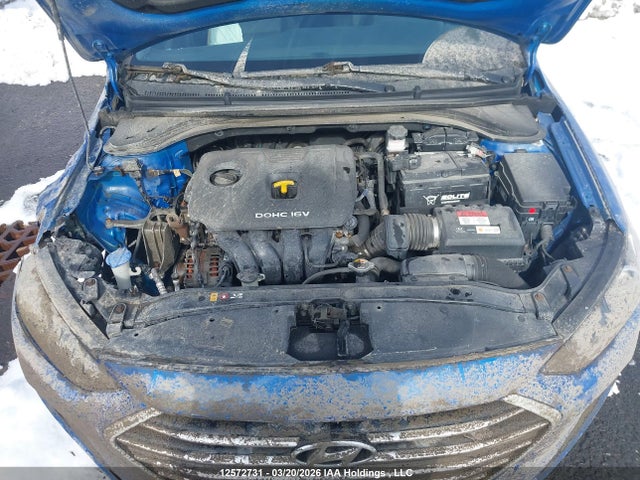 KMHD84LF1JU605829 Hyundai ELANTRA GL