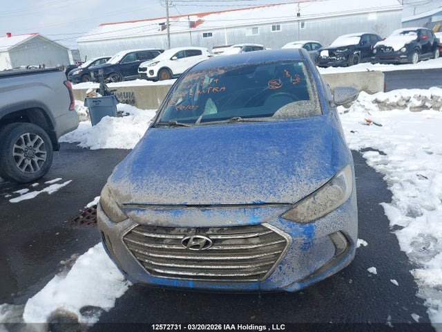 KMHD84LF1JU605829 Hyundai ELANTRA GL