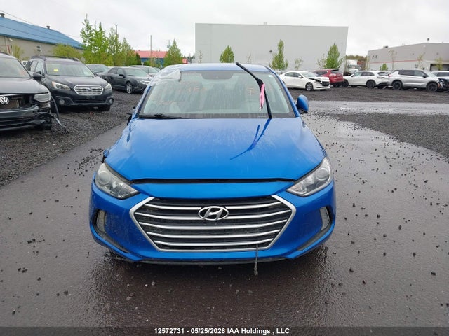 KMHD84LF1JU605829 Hyundai ELANTRA GL
