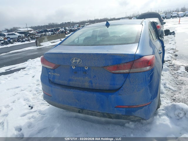 KMHD84LF1JU605829 Hyundai ELANTRA GL