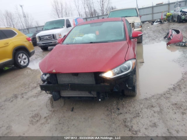 KMHD84LF1HU113666 Hyundai ELANTRA GL