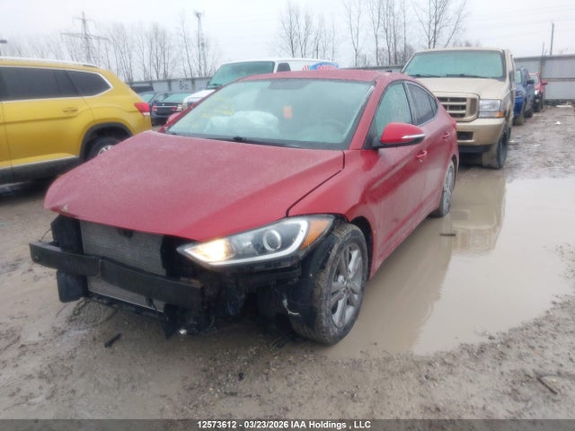 KMHD84LF1HU113666 Hyundai ELANTRA GL