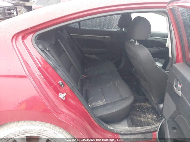 KMHD84LF1HU113666 Hyundai ELANTRA GL
