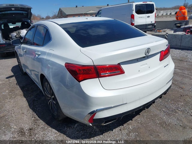 Acura TLX TECH 2018 19UUB3F55JA800046 Image 3