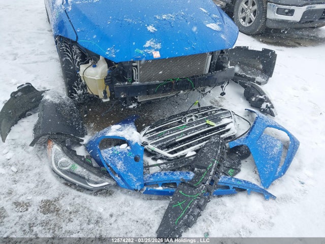 KMHD84LF0HU323272 Hyundai ELANTRA GL