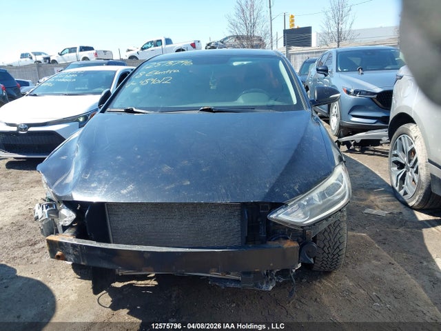 KMHD84LF7JU454012 Hyundai Elantra