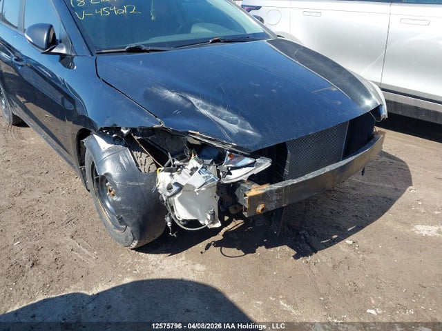 KMHD84LF7JU454012 Hyundai Elantra
