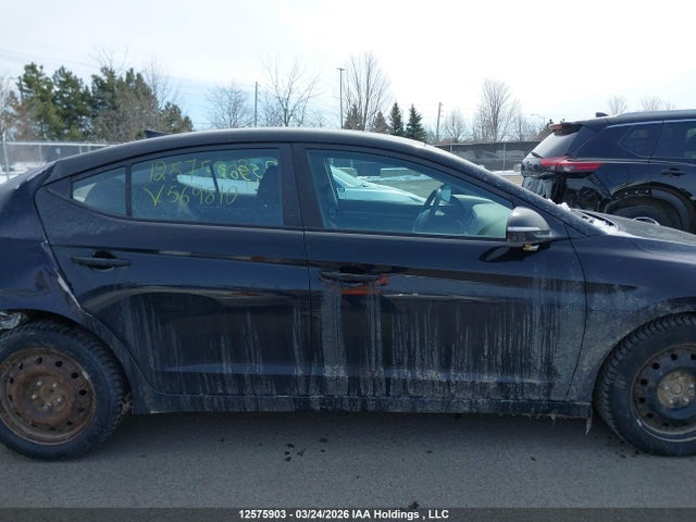 KMHD84LF7JU569810 Hyundai ELANTRA GL