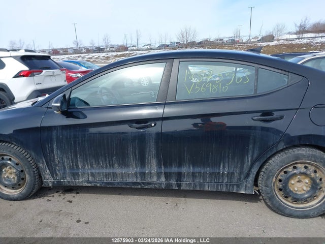 KMHD84LF7JU569810 Hyundai ELANTRA GL