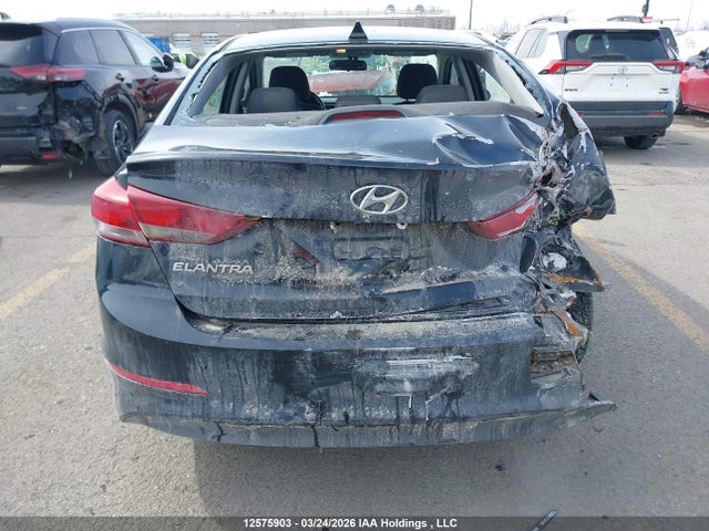 KMHD84LF7JU569810 Hyundai ELANTRA GL