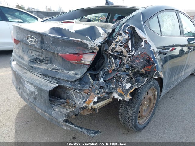 KMHD84LF7JU569810 Hyundai ELANTRA GL