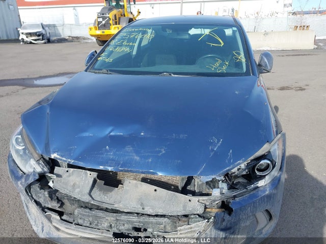 KMHD84LF3JU681844 Hyundai ELANTRA GL
