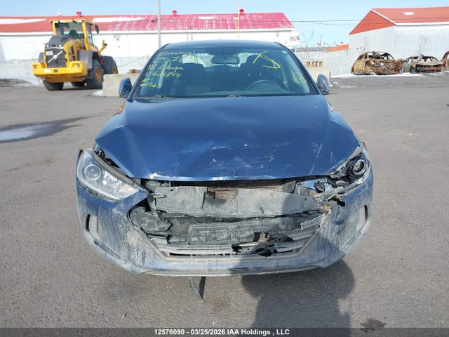 KMHD84LF3JU681844 Hyundai ELANTRA GL