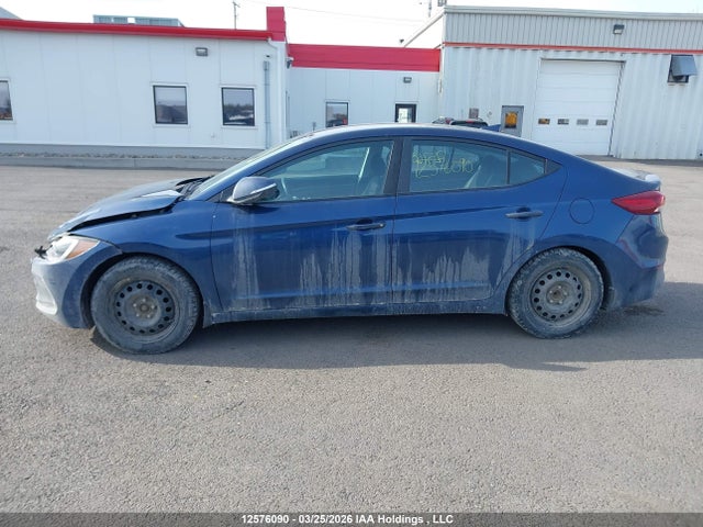 KMHD84LF3JU681844 Hyundai ELANTRA GL
