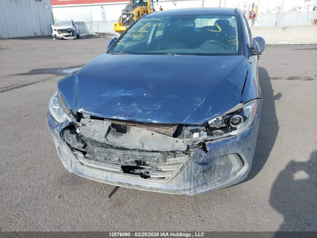 KMHD84LF3JU681844 Hyundai ELANTRA GL