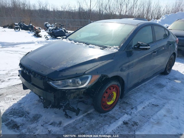 KMHD84LF1HU138096 Hyundai ELANTRA GL