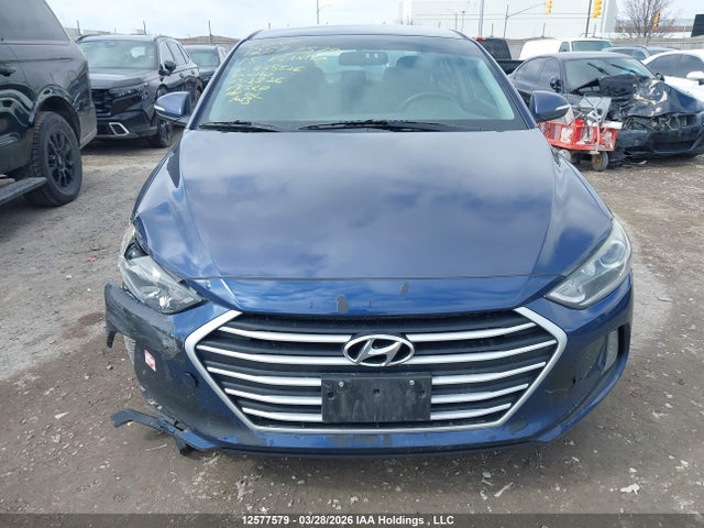 KMHD84LF8JU448526 Hyundai ELANTRA GL