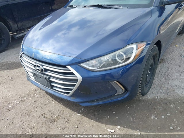 KMHD84LF8JU448526 Hyundai ELANTRA GL