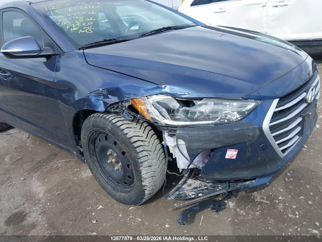 KMHD84LF8JU448526 Hyundai ELANTRA GL