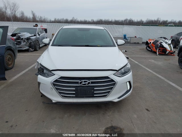 KMHD84LF6HU123481 Hyundai Elantra Se/value/limited