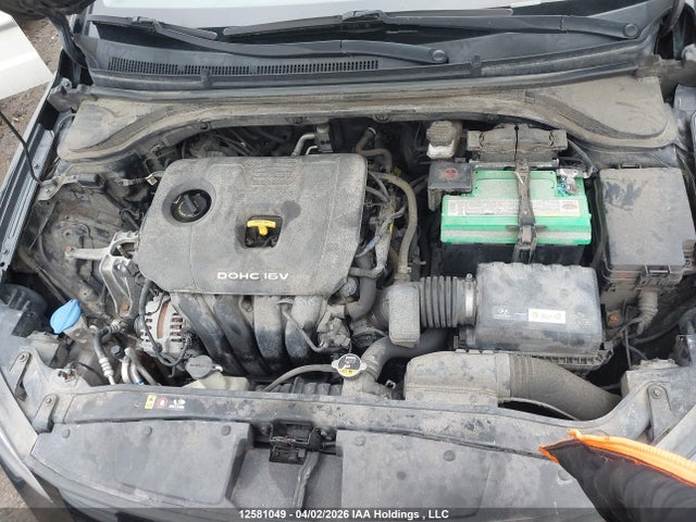 KMHD84LF0HU158565 Hyundai Elantra Se/value/limited