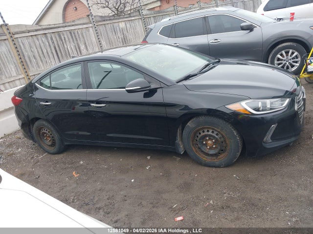 KMHD84LF0HU158565 Hyundai Elantra Se/value/limited