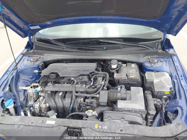 KMHLM4DG4SU036216 Hyundai Elantra Sel Sport