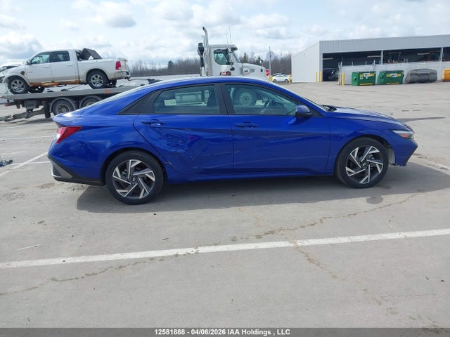 KMHLM4DG4SU036216 Hyundai Elantra Sel Sport