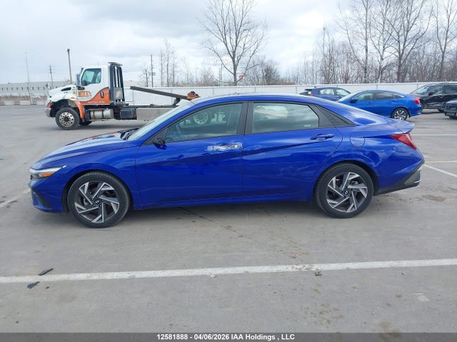 KMHLM4DG4SU036216 Hyundai Elantra Sel Sport
