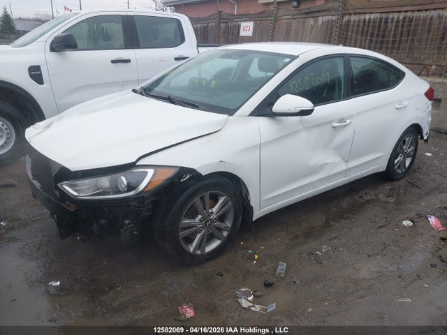KMHD84LF3HU138729 Hyundai ELANTRA GL