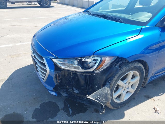 KMHD84LF0JU541685 Hyundai Elantra Sel/value/limited