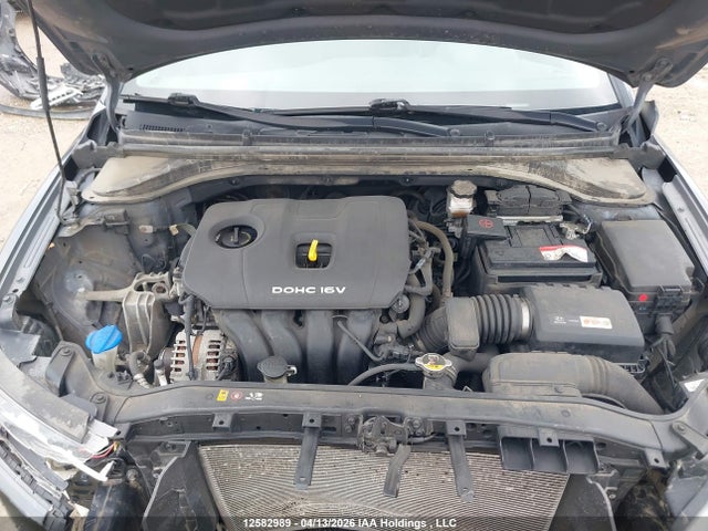 KMHD84LF1HU330666 Hyundai Elantra Se/value/limited