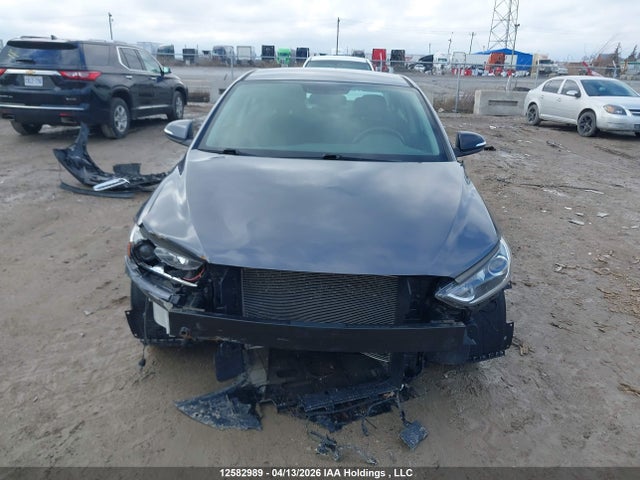 KMHD84LF1HU330666 Hyundai Elantra Se/value/limited