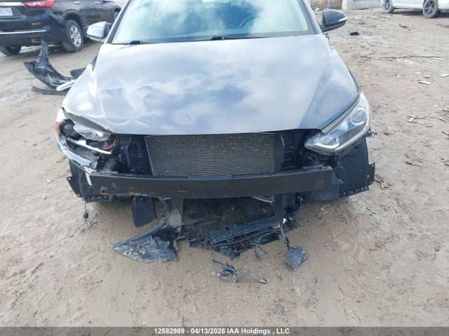 KMHD84LF1HU330666 Hyundai Elantra Se/value/limited