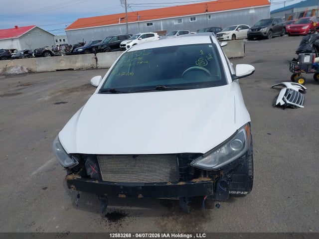 KMHD84LF0HU266216 Hyundai ELANTRA GL