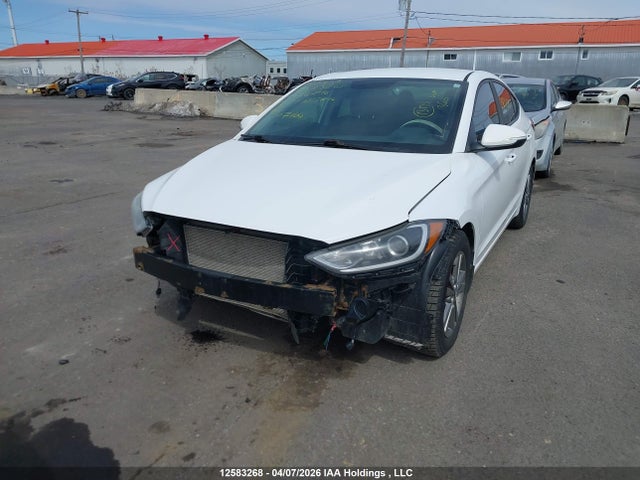 KMHD84LF0HU266216 Hyundai ELANTRA GL