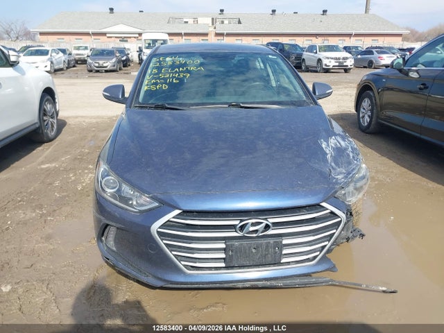KMHD84LF6JU521439 Hyundai ELANTRA GL