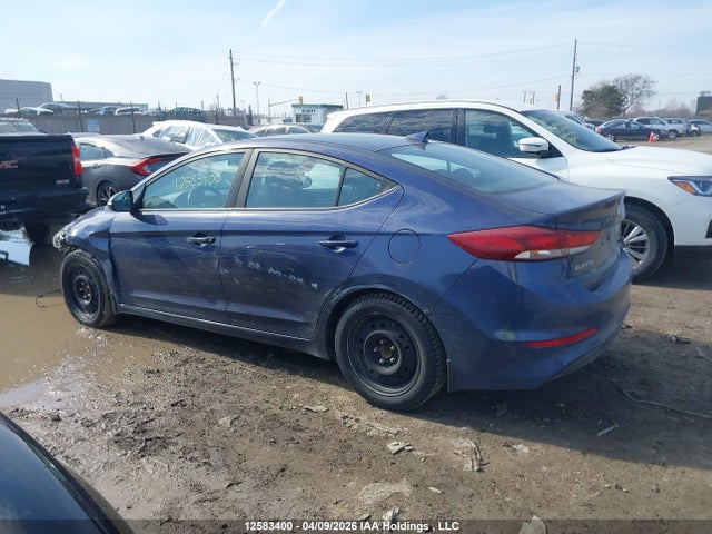 KMHD84LF6JU521439 Hyundai ELANTRA GL