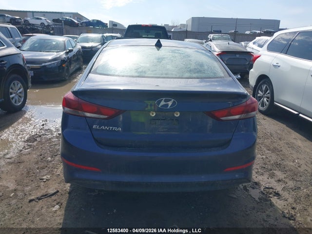 KMHD84LF6JU521439 Hyundai ELANTRA GL
