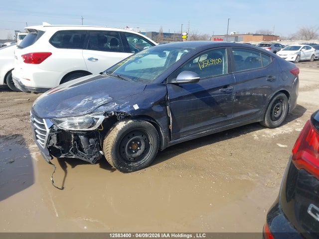 KMHD84LF6JU521439 Hyundai ELANTRA GL