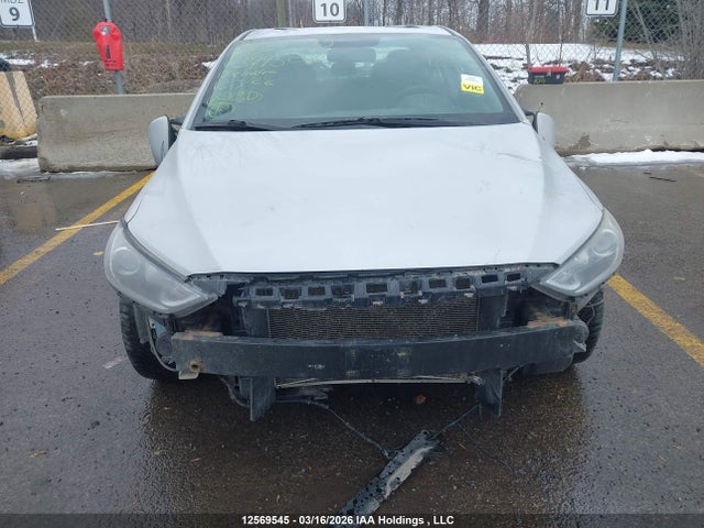 KMHD84LFXHU379509 Hyundai Elantra Gls