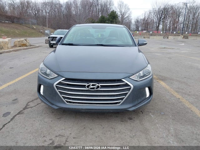 KMHD84LF7HU399636 Hyundai ELANTRA GL