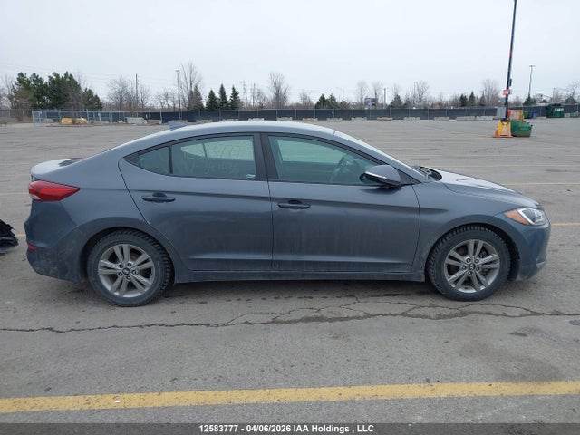 KMHD84LF7HU399636 Hyundai ELANTRA GL