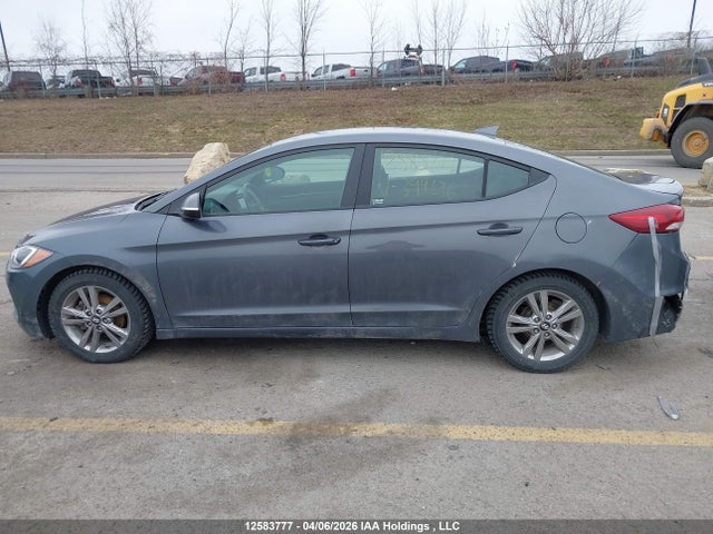 KMHD84LF7HU399636 Hyundai ELANTRA GL