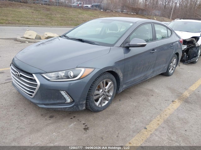KMHD84LF7HU399636 Hyundai ELANTRA GL