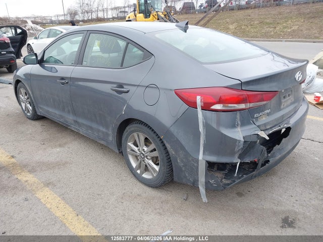 KMHD84LF7HU399636 Hyundai ELANTRA GL