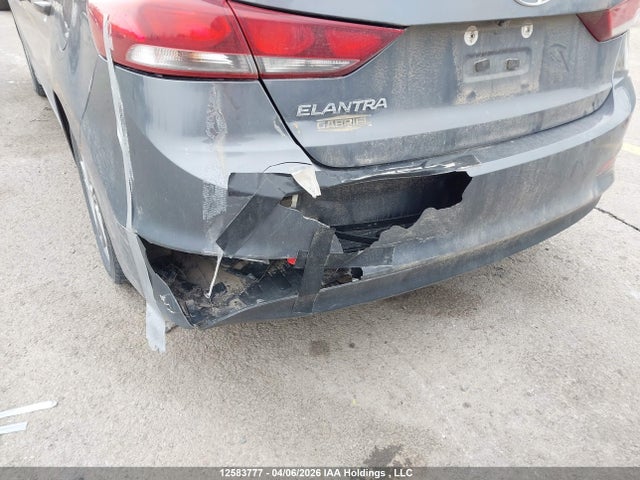 KMHD84LF7HU399636 Hyundai ELANTRA GL