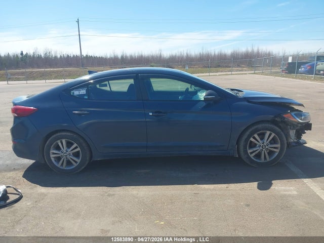 12583890 :رقم المزاد ، KMHD84LF3HU182357 vin ، 2017 Hyundai Elantra Se/value/limited مزاد بيع