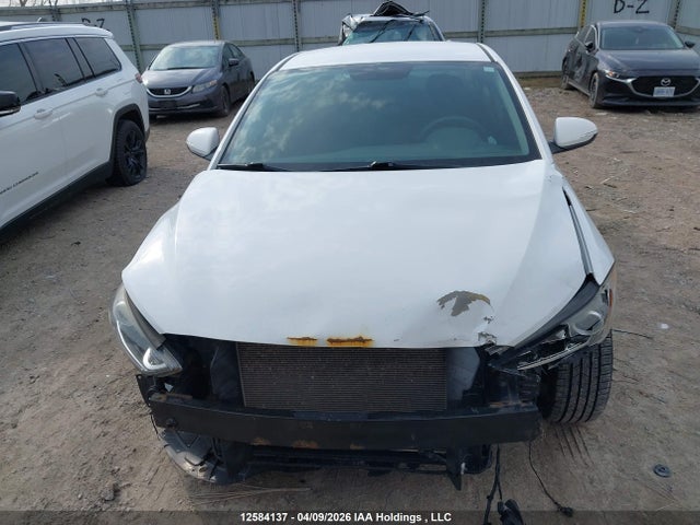 KMHD84LF5HU276403 Hyundai ELANTRA GL