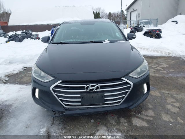 KMHD84LF9JU512329 Hyundai Elantra Sel/value/limited